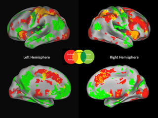 Illustration for article titled Brain Scans Reveal When Your Decisions Are Getting Risky
